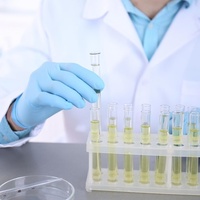 Фото: Общий анализ мочи