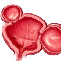 Фото: Врожденные аномалии мочевого пузыря: мировые и отечественные данные