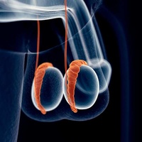 Фото: Эпидидимит