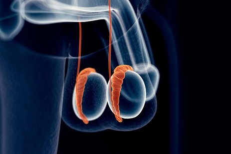 Фото: Эпидидимит