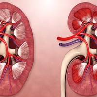 Фото: Гломерулонефрит