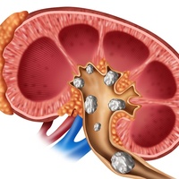 Фото: Дизурия - расстройство процесса мочеиспускания у женщин и мужчин
