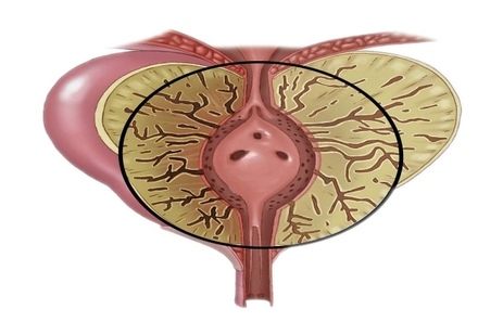 Фото: Колликулит