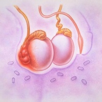 Фото: Семинома