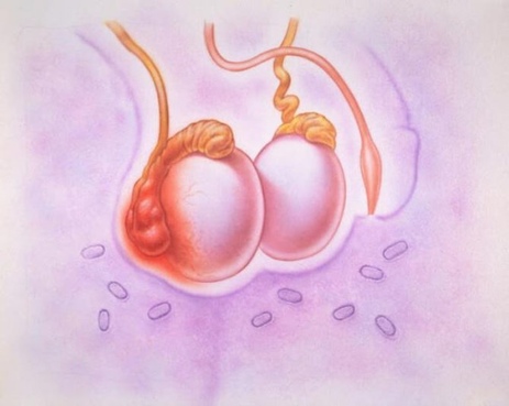 Фото: Семинома