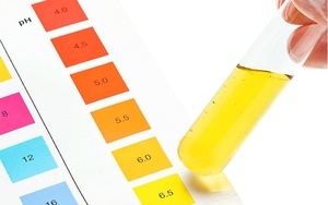 Фото: Цвет мочи