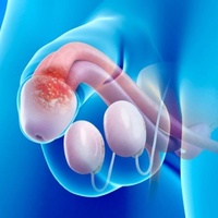 Фото: Баланопостит - воспаления полового члена