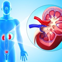 Фото: Острая почечная недостаточность