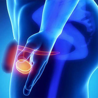 Фото: Опухоли яичка