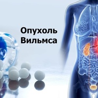 Фото: Опухоль Вильмса