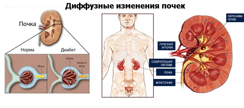 Фото: Структурные изменения