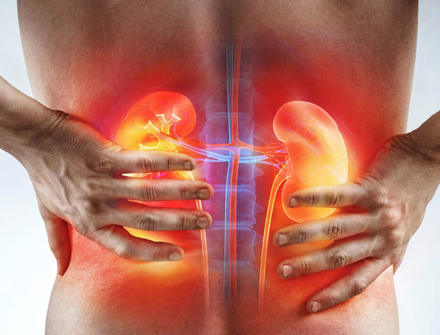 Фото: Урология. Симптомы болезней