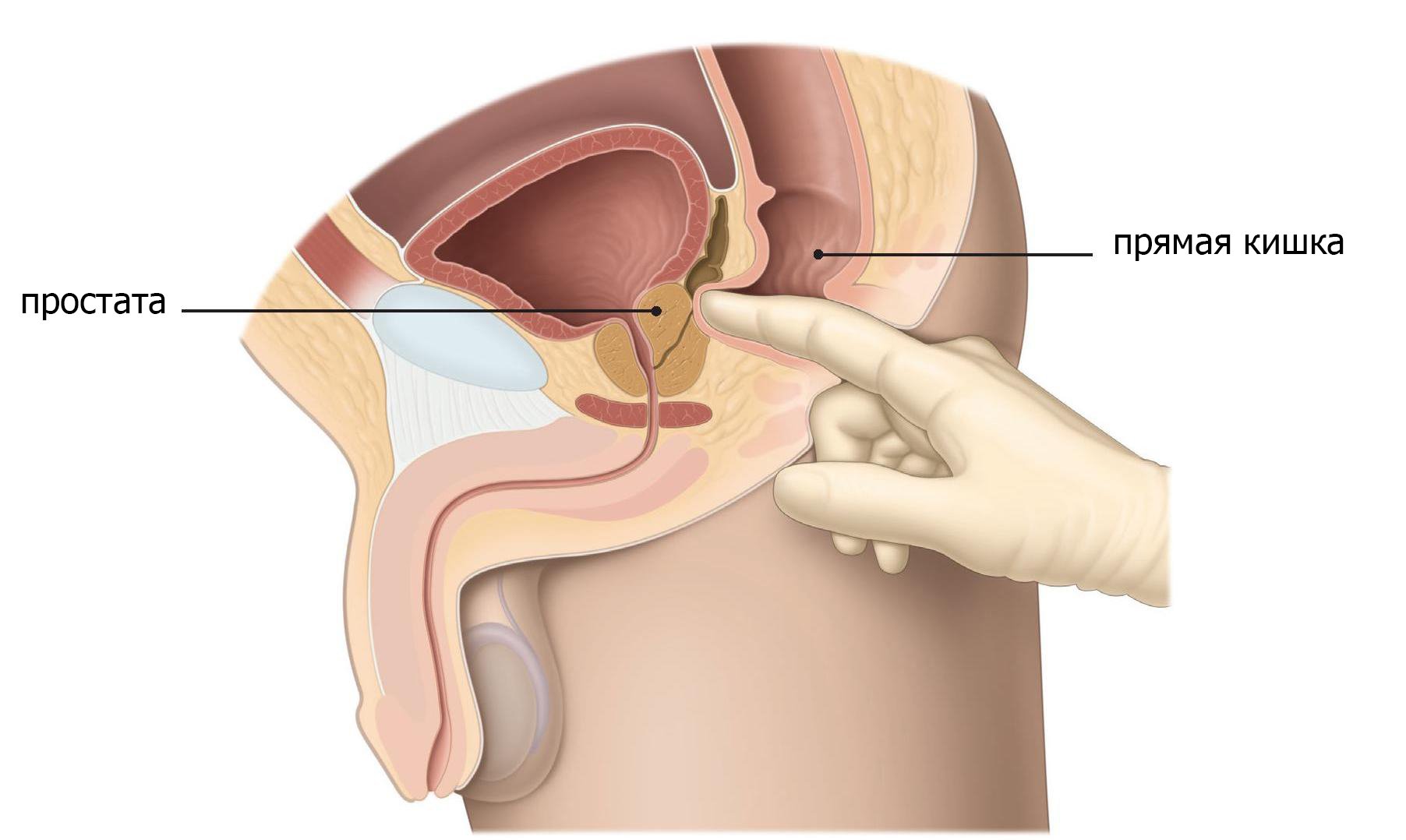 Фото: Лечение простатита массажем